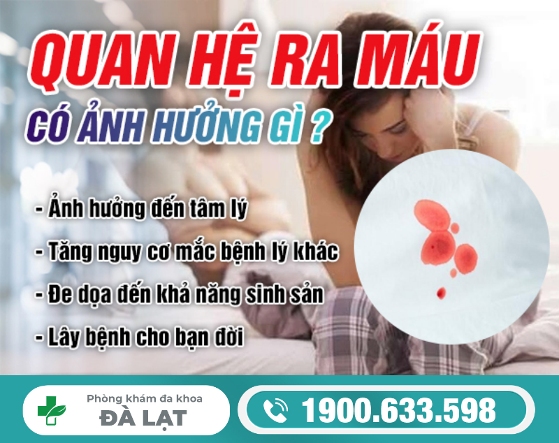 Hình ảnh minh họa